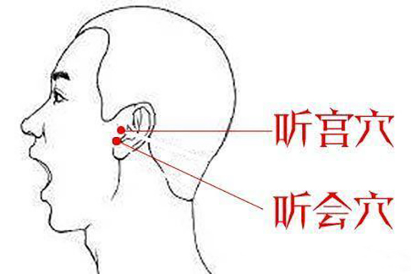 如何确定是神经性耳鸣