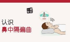 鼻中隔偏曲药物治疗可靠吗
