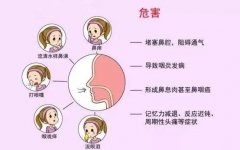 日常如何预防过敏性鼻炎