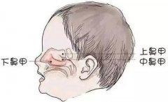 鼻甲肥大的常见症状有哪些