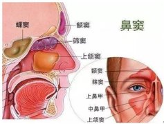 重庆好的耳鼻喉医院_鼻窦炎的早期症状及预防