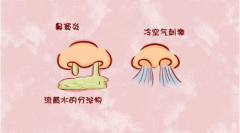 重庆耳鼻喉医院_怎样预防鼻窦炎有效