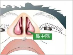 鼻中隔偏曲在什么情况下才需要做手术？