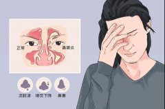 儿科鼻窦炎的病因有哪些？重庆耳鼻喉医院