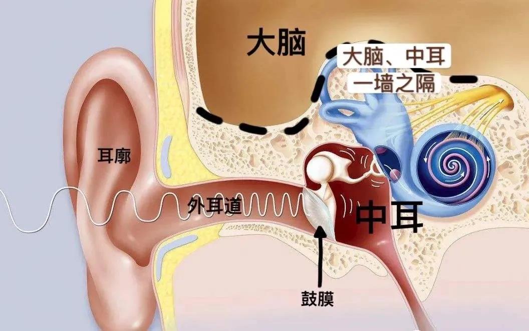 中耳炎