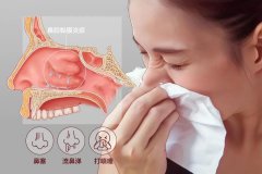 慢性鼻炎的分类和病症都有哪些？如何预防？