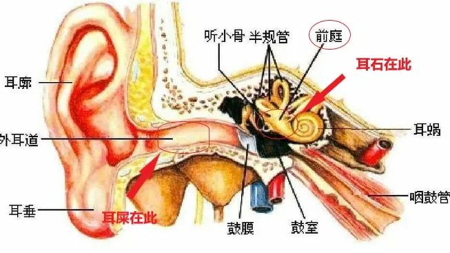 耳石症