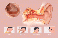 重庆耳鼻喉医院,分泌性中耳炎怎么引起的