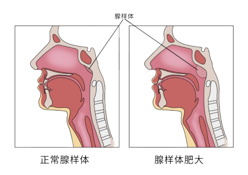 重庆耳鼻喉医院