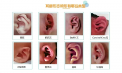 <b>不手术矫正小耳畸形，时间很重要，错过至少等6年，孩子还得经历手术，详情</b>