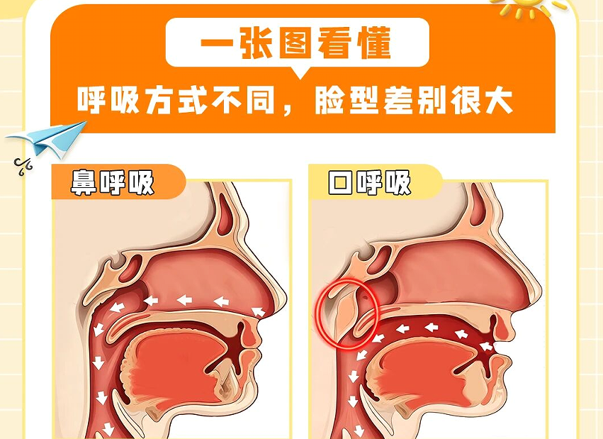 别让口呼吸毁了孩子颜值和健康，四步纠正